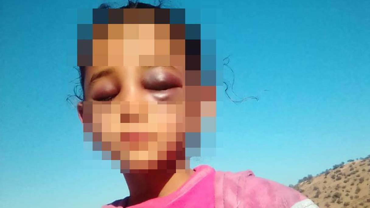 الطفلة الضحية مريم (8 سنوات)
