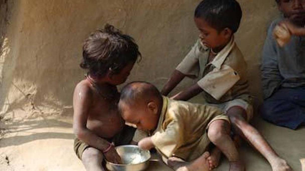أطفال يعانون سوء التغذية
