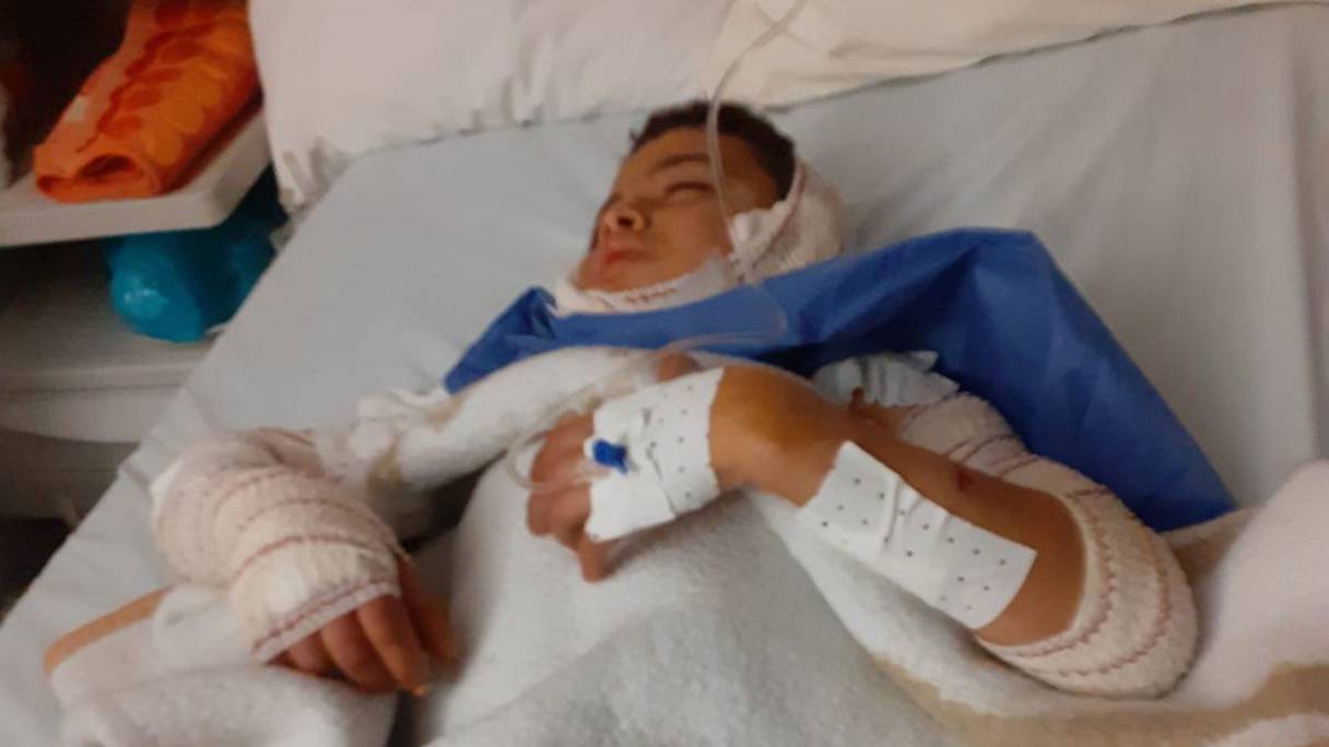 طفل يرقد بالمستشفى بعد تعرضه لهجوم كلاب شرسة داخل مدرسة بوجدة
