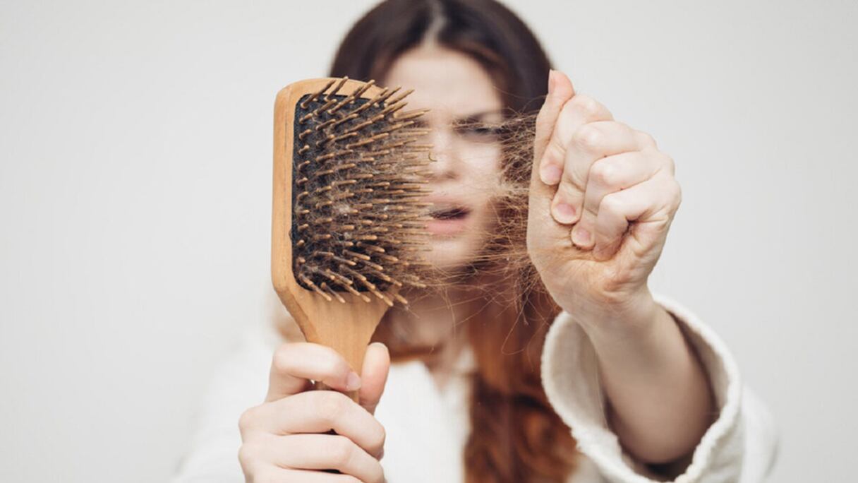 تساقط الشعر "صورة تعبيرية"