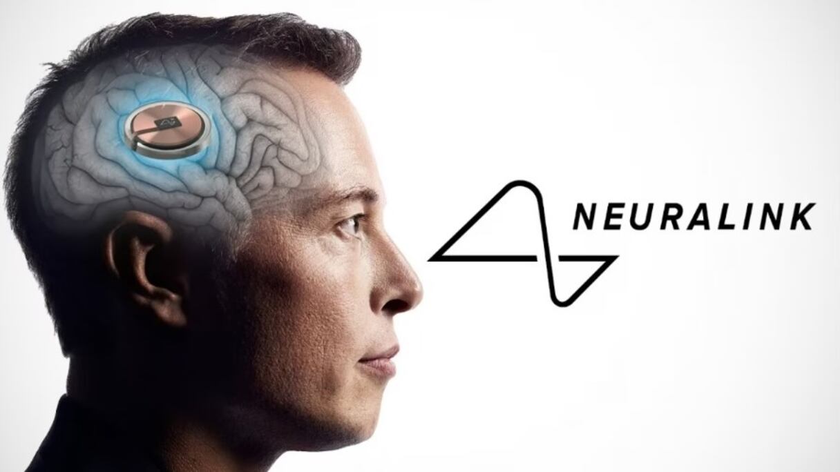 شركة "Neuralink" المملوكة للملياردير ماسك تعلن حصولها على ترخيص لإجراء تجربة زراعة شريحة إلكترونية في دماغ بشري
