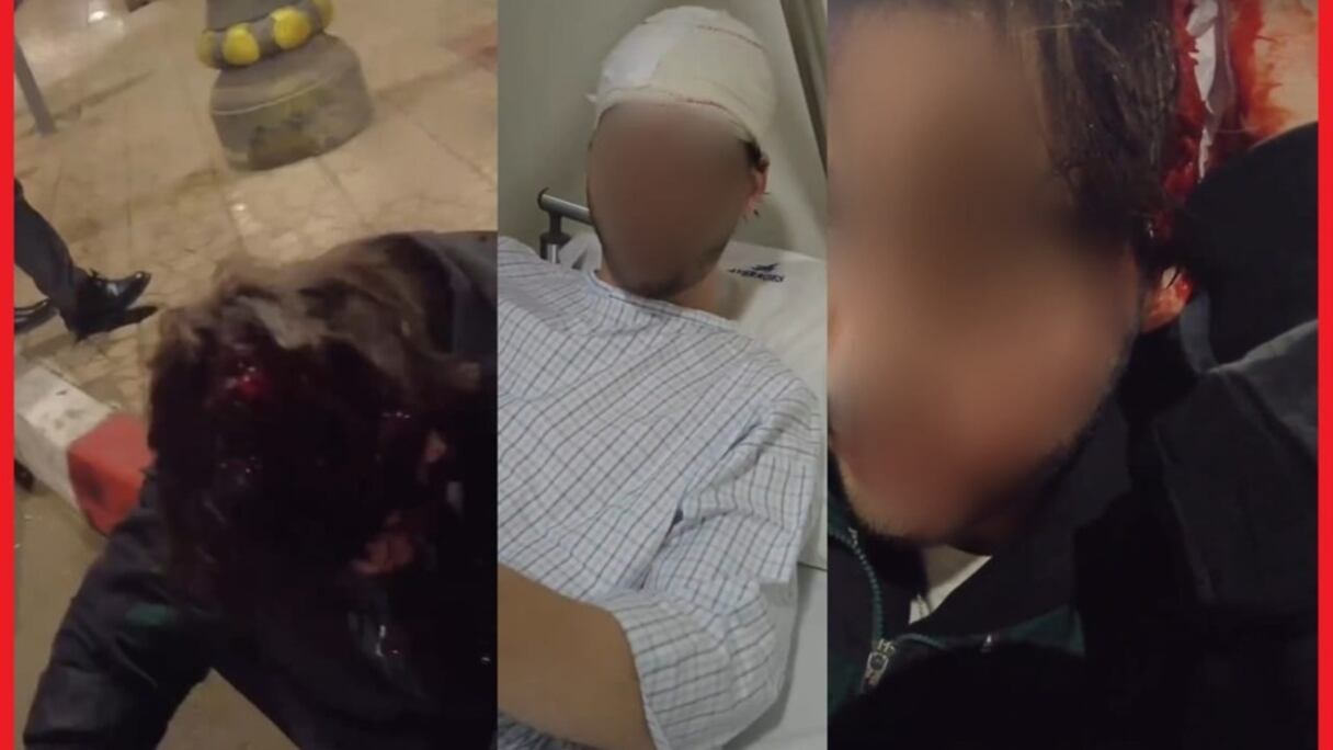 إصابة الأجنبي