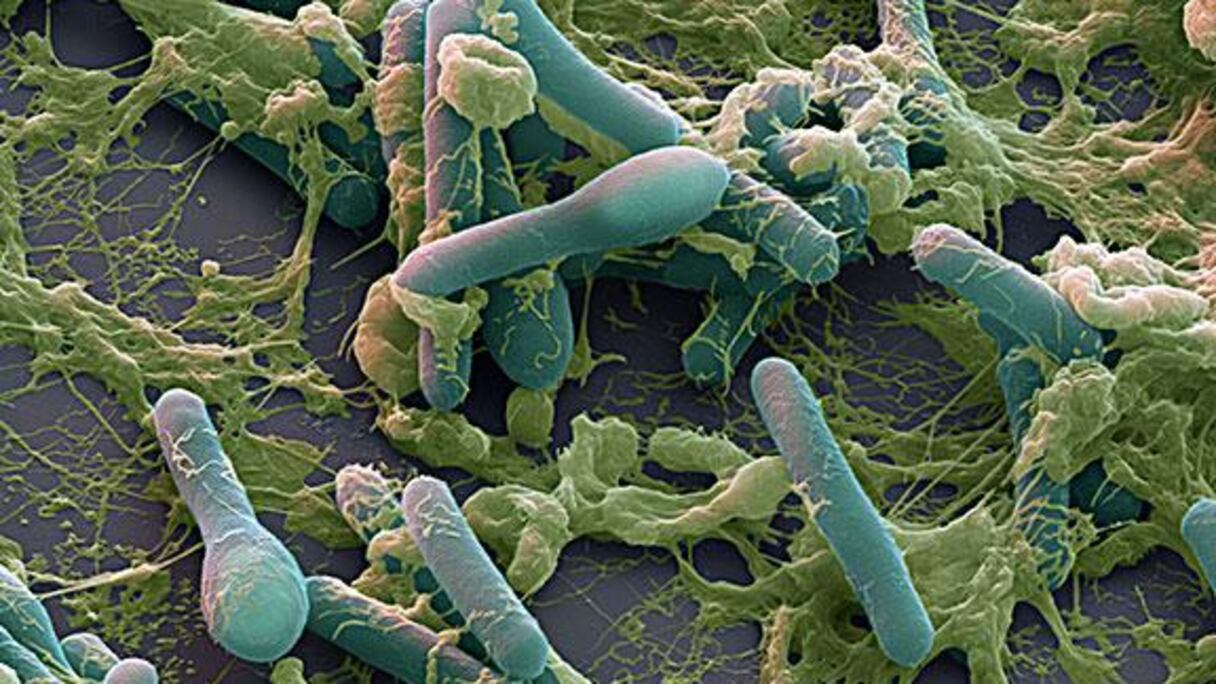 بكتيريا كلوستريديوم