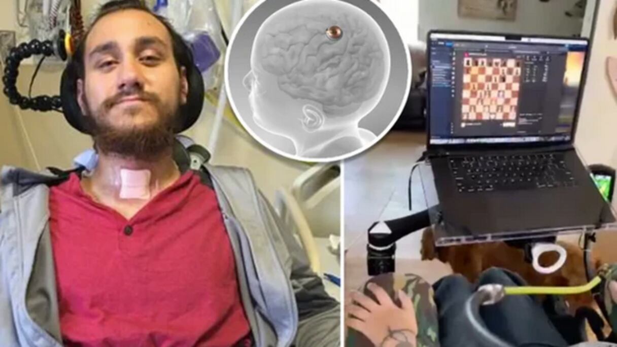 نولاند أرباو