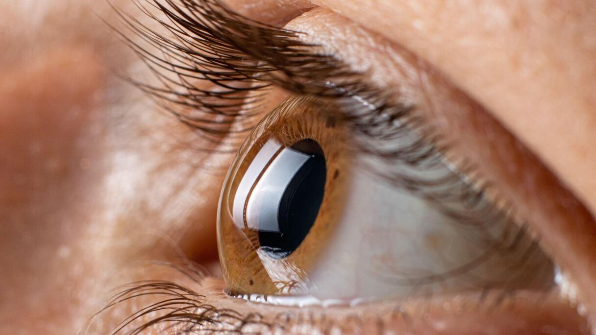 صورة لعين بشرية