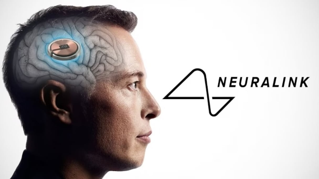 شركة "Neuralink" المملوكة للملياردير ماسك تعلن حصولها على ترخيص لإجراء تجربة زراعة شريحة إلكترونية في دماغ بشري