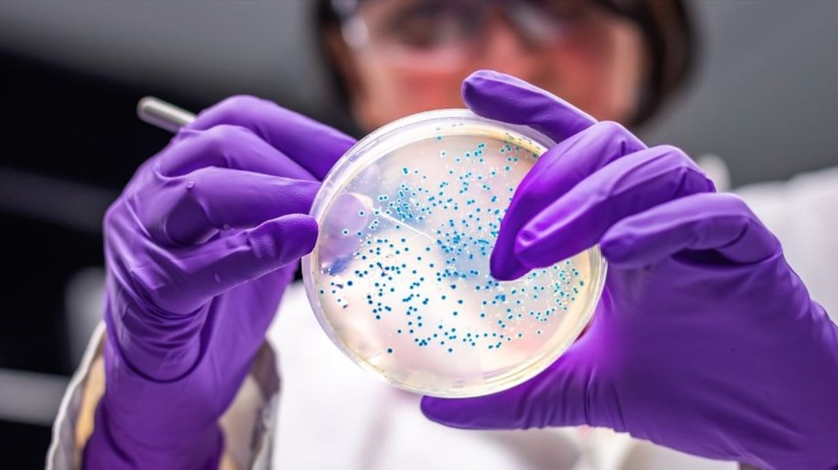 بكتيريا السالمونيلا
